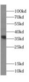 Chromosome 1 Open Reading Frame 56 antibody, FNab01067, FineTest, Western Blot image 