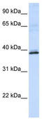 Hydroxyacid Oxidase 2 antibody, TA346057, Origene, Western Blot image 