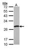 Protein-L-Isoaspartate (D-Aspartate) O-Methyltransferase antibody, PA5-22122, Invitrogen Antibodies, Western Blot image 
