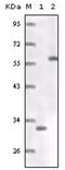 Estrogen Receptor 1 antibody, AM06176SU-N, Origene, Western Blot image 