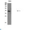 HAVcr-1 antibody, LS-C813946, Lifespan Biosciences, Western Blot image 