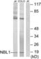 NBL1, DAN Family BMP Antagonist antibody, LS-C118889, Lifespan Biosciences, Western Blot image 