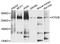 Autophagy Related 2B antibody, STJ110796, St John