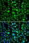TEK Receptor Tyrosine Kinase antibody, STJ29302, St John