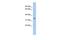 Zinc Finger DHHC-Type Containing 24 antibody, GTX45141, GeneTex, Western Blot image 