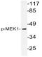 Mitogen-Activated Protein Kinase Kinase 1 antibody, AP20802PU-N, Origene, Western Blot image 