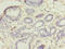 Ubiquitin-conjugating enzyme E2 D1 antibody, LS-C370523, Lifespan Biosciences, Immunohistochemistry paraffin image 