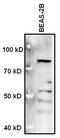 Methyl-CpG Binding Protein 2 antibody, PA1-887, Invitrogen Antibodies, Western Blot image 