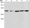 3-ketoacyl-CoA thiolase, mitochondrial antibody, LS-C401149, Lifespan Biosciences, Western Blot image 