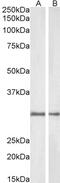 DT-diaphorase antibody, 45-981, ProSci, Enzyme Linked Immunosorbent Assay image 