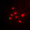 TATA-Box Binding Protein antibody, LS-C358352, Lifespan Biosciences, Immunofluorescence image 