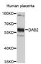 DAB Adaptor Protein 2 antibody, STJ23332, St John