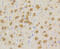 Cyclin Dependent Kinase 5 antibody, 13-813, ProSci, Immunohistochemistry paraffin image 