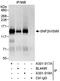 SWI/SNF Related, Matrix Associated, Actin Dependent Regulator Of Chromatin, Subfamily A, Member 5 antibody, A301-018A, Bethyl Labs, Immunoprecipitation image 