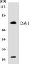 Disabled homolog 1 antibody, LS-C291867, Lifespan Biosciences, Western Blot image 