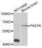 Fas-activated serine/threonine kinase antibody, LS-C346216, Lifespan Biosciences, Western Blot image 