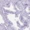 Leucine Rich Repeat Containing 18 antibody, HPA039256, Atlas Antibodies, Immunohistochemistry paraffin image 