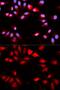 Regulator Of Calcineurin 1 antibody, GTX33055, GeneTex, Immunofluorescence image 