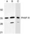 Acidic Nuclear Phosphoprotein 32 Family Member E antibody, GTX25993, GeneTex, Western Blot image 