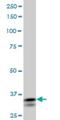 PRX-3 antibody, H00006474-M01, Novus Biologicals, Western Blot image 