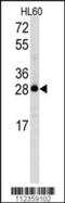 Latexin antibody, 57-909, ProSci, Western Blot image 