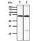 Alpha Fetoprotein antibody, GTX57721, GeneTex, Western Blot image 