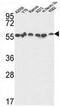 NLK antibody, AP51910PU-N, Origene, Western Blot image 