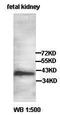 Arylacetamide Deacetylase Like 2 antibody, orb77612, Biorbyt, Western Blot image 