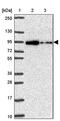 Aldehyde dehydrogenase family 16 member A1 antibody, PA5-63737, Invitrogen Antibodies, Western Blot image 