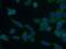 Doublecortin Domain Containing 2 antibody, 26978-1-AP, Proteintech Group, Immunofluorescence image 