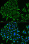 DEAD-Box Helicase 1 antibody, 22-324, ProSci, Immunoprecipitation image 