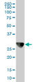 Capping Actin Protein Of Muscle Z-Line Subunit Beta antibody, LS-B5931, Lifespan Biosciences, Western Blot image 