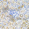 Protein Kinase AMP-Activated Non-Catalytic Subunit Gamma 1 antibody, A7300, ABclonal Technology, Immunohistochemistry paraffin image 