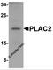 Placenta-specific protein 2 antibody, 6017, ProSci Inc, Western Blot image 
