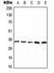 Protein Phosphatase 2 Catalytic Subunit Alpha antibody, LS-C352698, Lifespan Biosciences, Western Blot image 