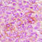 Insulin Like Growth Factor 2 Receptor antibody, LS-C359020, Lifespan Biosciences, Immunohistochemistry paraffin image 