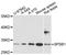 SplA/Ryanodine Receptor Domain And SOCS Box Containing 1 antibody, A13886, ABclonal Technology, Western Blot image 