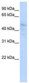 Delta-like protein 3 antibody, TA342026, Origene, Western Blot image 
