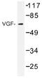 Neurosecretory protein VGF antibody, AP01489PU-N, Origene, Western Blot image 
