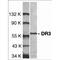 TNF Receptor Superfamily Member 25 antibody, TA305961, Origene, Western Blot image 