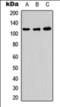 ADAM Metallopeptidase With Thrombospondin Type 1 Motif 10 antibody, orb376132, Biorbyt, Western Blot image 