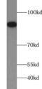 Fibroblast Growth Factor Receptor 1 antibody, FNab03099, FineTest, Western Blot image 
