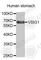 V-Set And Immunoglobulin Domain Containing 1 antibody, A5223, ABclonal Technology, Western Blot image 