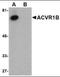Activin A Receptor Type 1 antibody, orb88378, Biorbyt, Western Blot image 