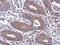 SAT antibody, GTX107427, GeneTex, Immunohistochemistry paraffin image 