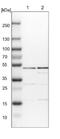 Inositol-Pentakisphosphate 2-Kinase antibody, NBP1-86712, Novus Biologicals, Western Blot image 