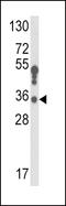 Hydroxysteroid 17-Beta Dehydrogenase 3 antibody, LS-C165035, Lifespan Biosciences, Western Blot image 