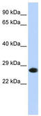 Proteasome Subunit Alpha 2 antibody, TA342160, Origene, Western Blot image 
