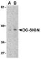 CD209 Molecule antibody, TA319910, Origene, Western Blot image 