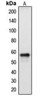 Cytochrome P450 2A13 antibody, GTX56282, GeneTex, Western Blot image 